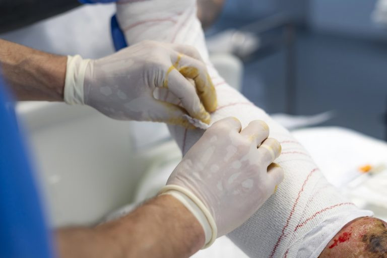 Projeto garante assistência integral e cirurgias reparadoras para vítimas de queimaduras  